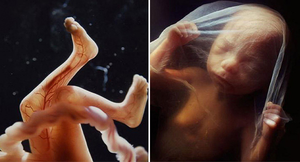 The Miracle Of Life - Photos Reveal The Stages Of Development Of A Baby In The Womb